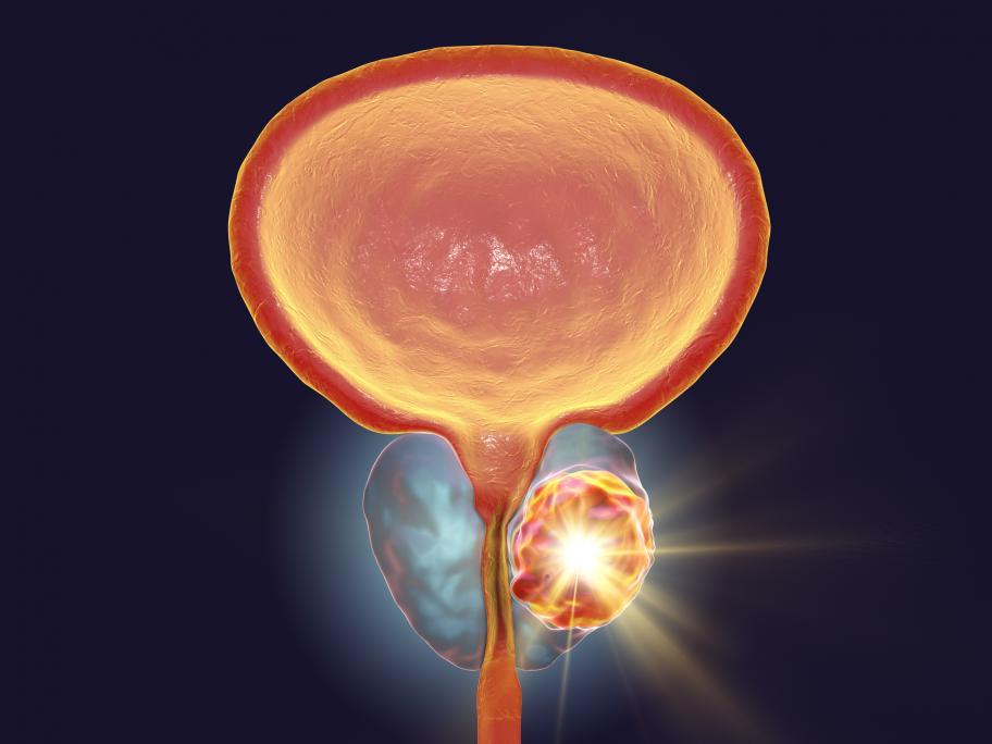 Prostate