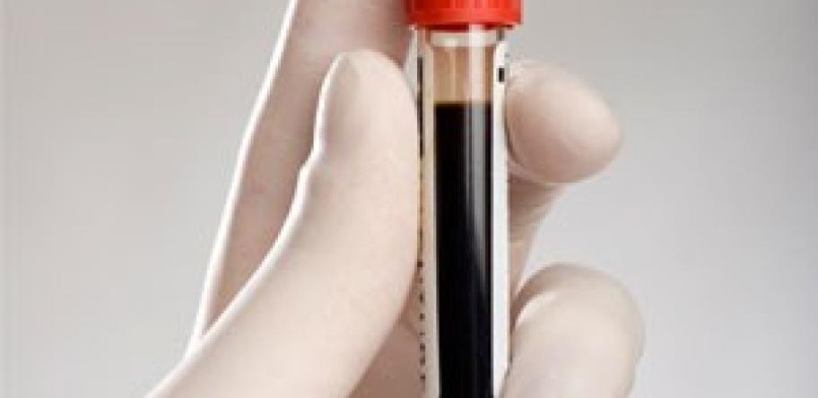 Blood test