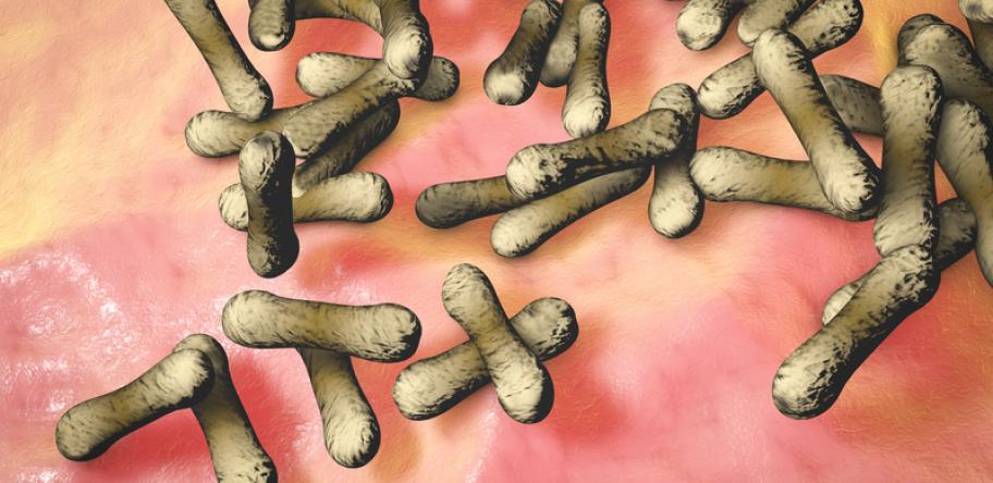 diphtheria bacteria