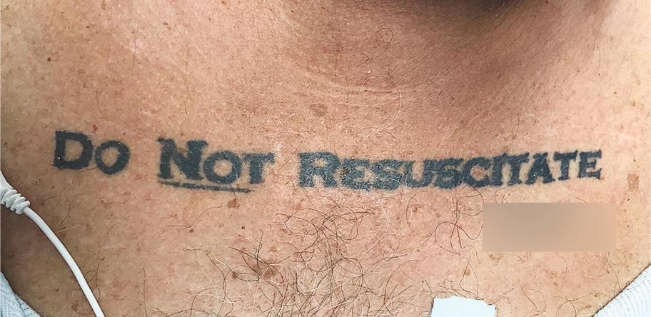 DNR tattoo