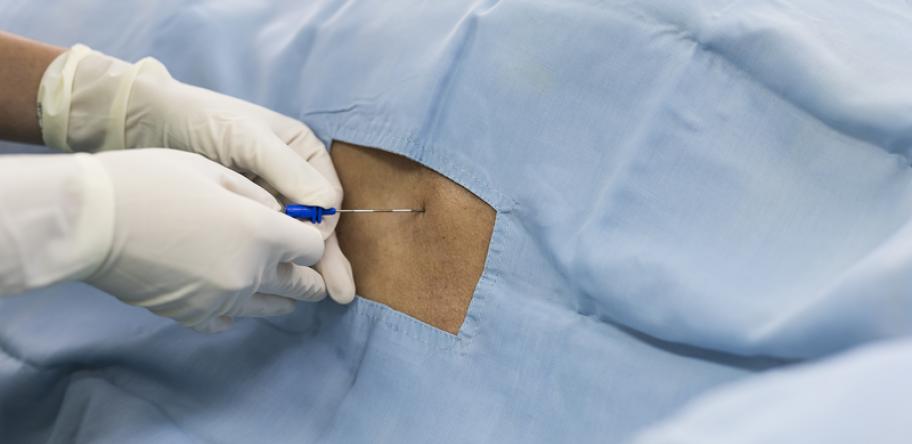 epidural