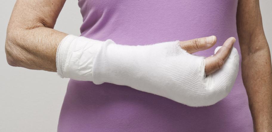 fracture
