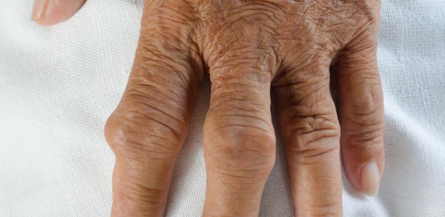 gout