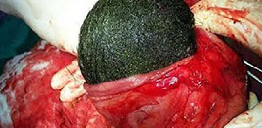 hairball