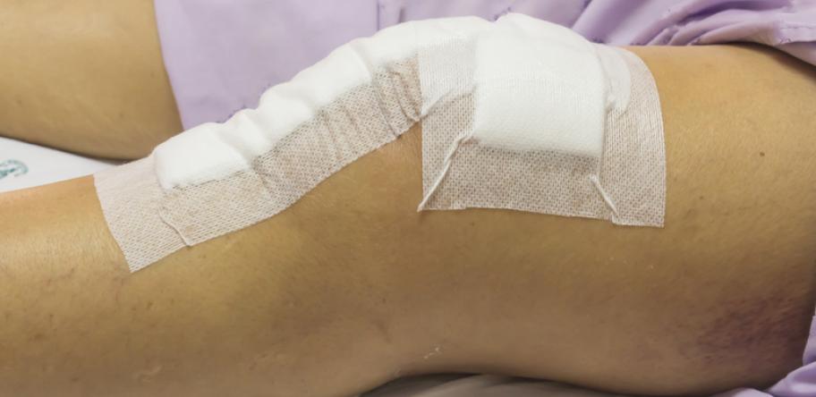 knee replacement surgery
