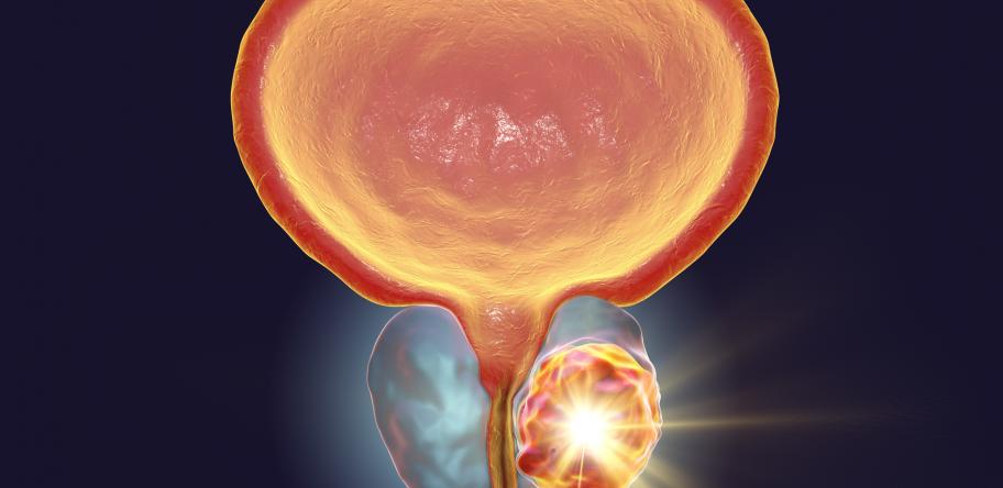 Prostate