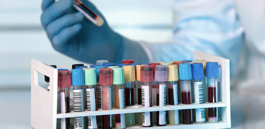 Blood tests