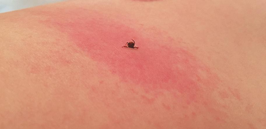 Tick