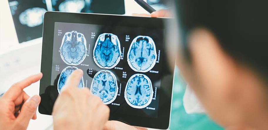 Brain MRI scan