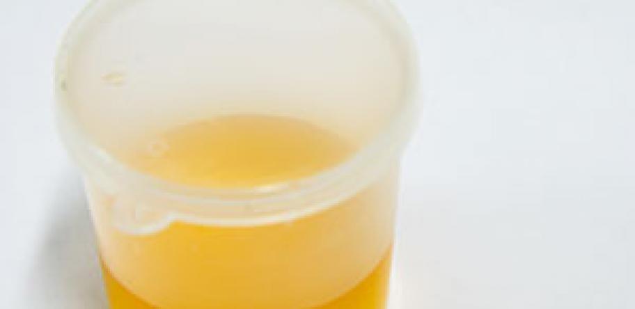 Urine