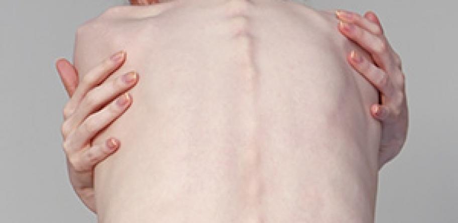 thin girl
