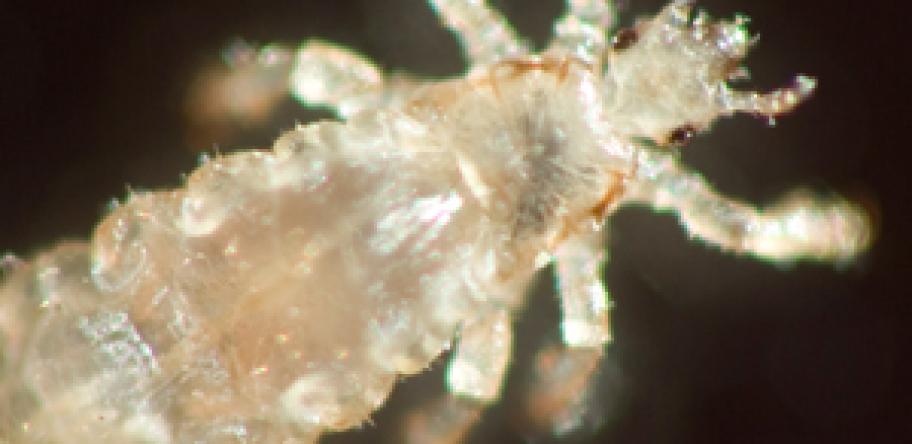Scabies drug effective for head lice | Australian Doctor