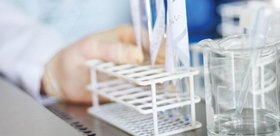 Stroke and heart disease research