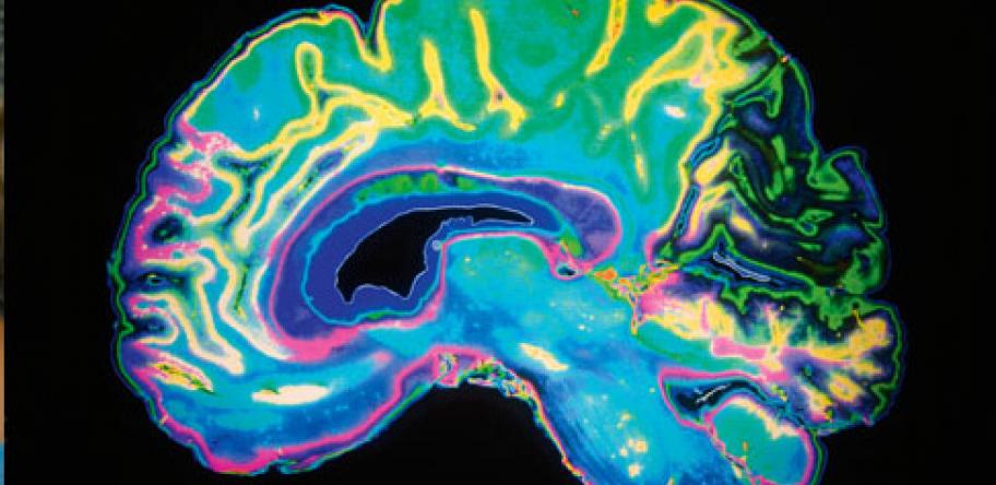 brain image