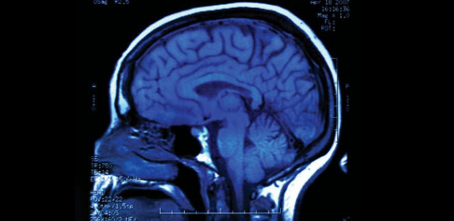 Procedures are used to identify the source of seizures in epilepsy