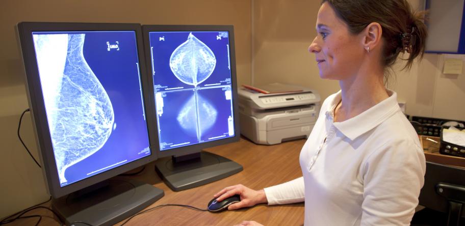Mammogram