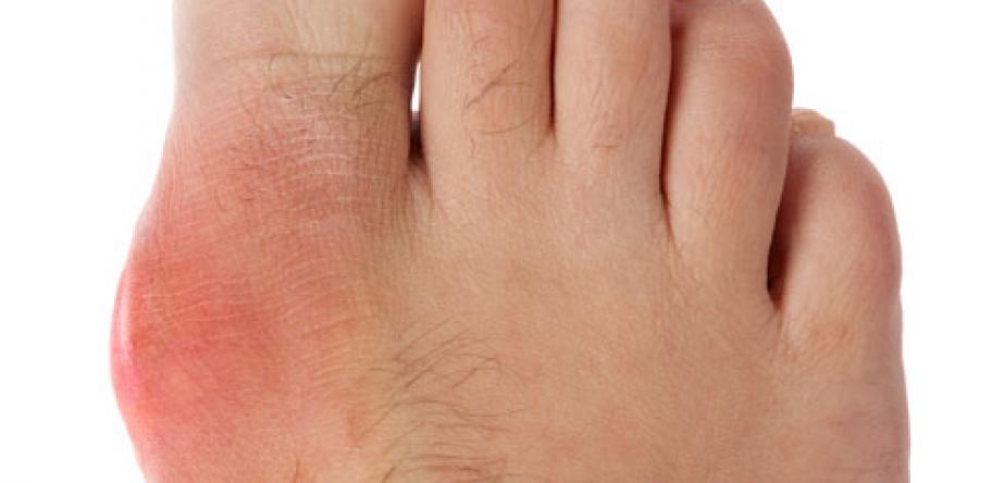 gout