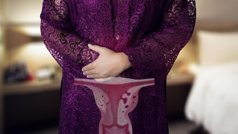 adenomyosis